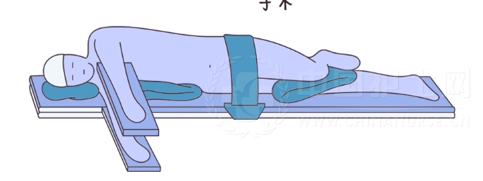 侧卧位